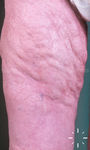 F7584-K-00104