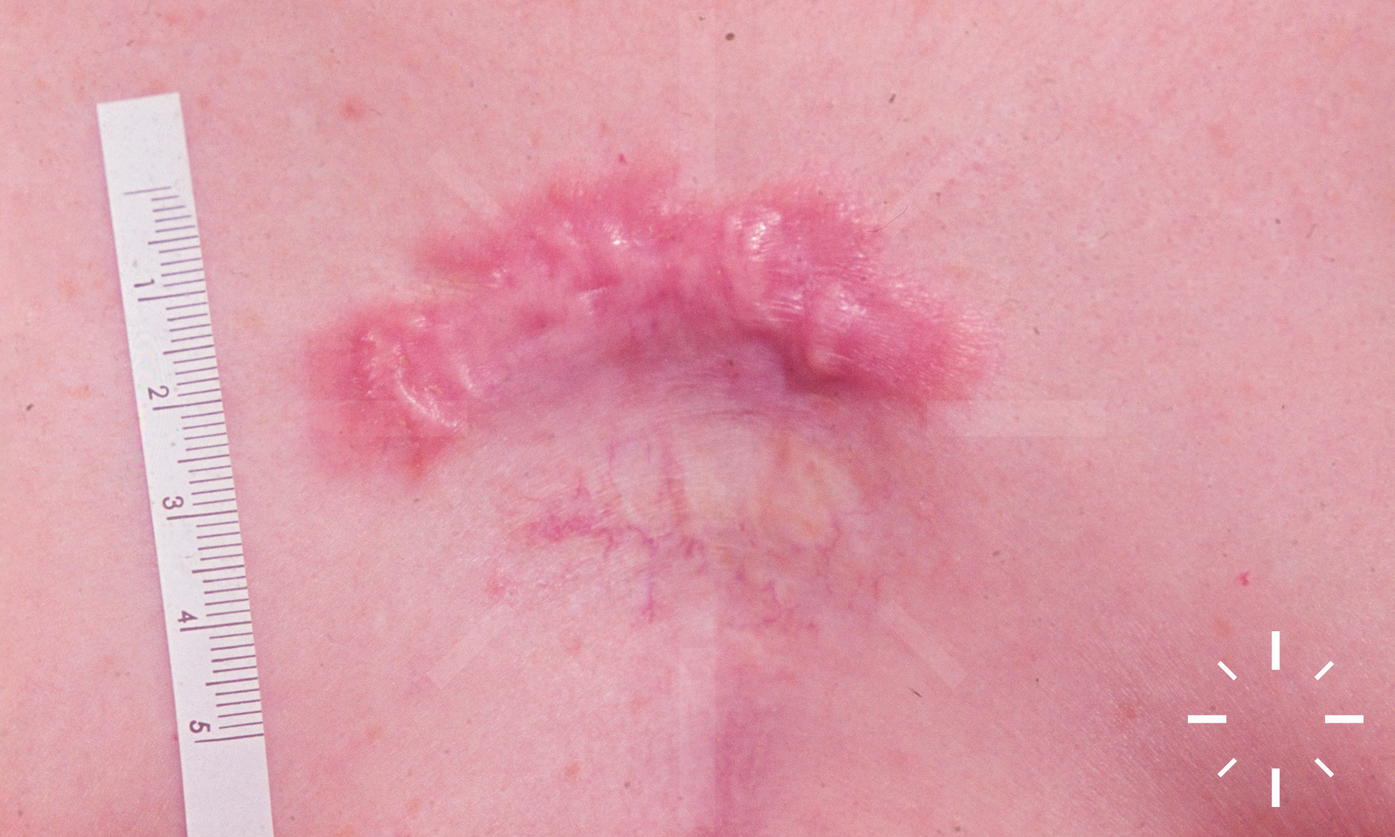 ckhp5voup0014d05winhb8tfy-v7584-k-01800.jpg