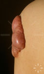 V7584-K-01830