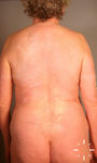 V7584-K-03130