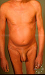 V7584-K-03157