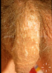 S7584-K-2585