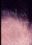 V7584-K-03439